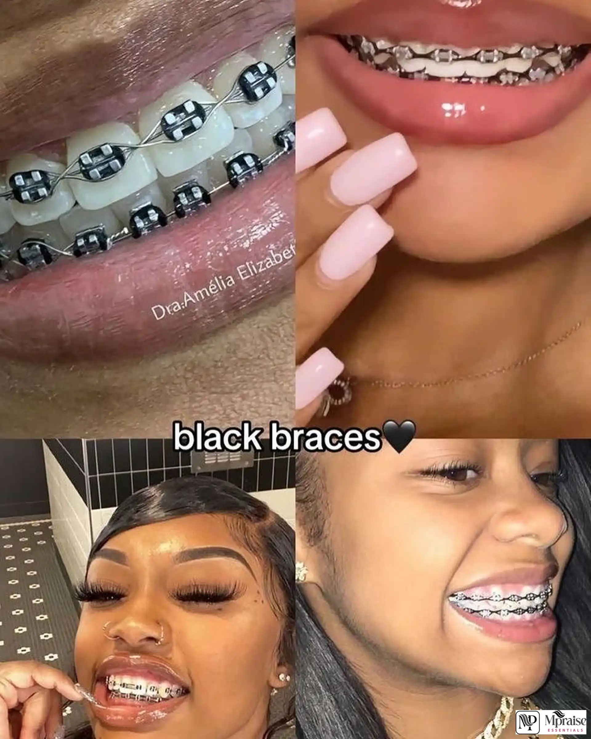 Teeth braces